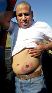 Hombre lesionado con balas de goma 