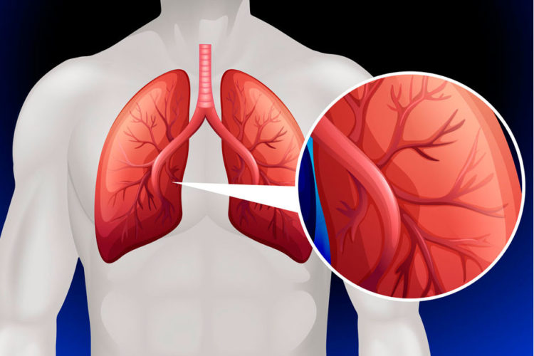 La Hipertensin Arterial Pulmonar Hap